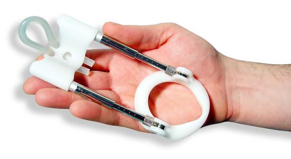 Extensor, um die Größe eines Mitglieds zu erhöhen